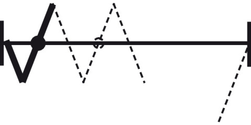 Hawa Centrefold 80H Fitting Set - Set 2